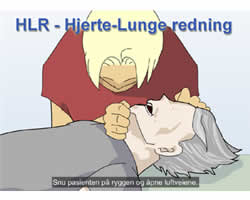 Hjerte-Lunge-redning